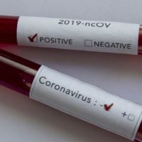 Coronavirus Becoming Much Less Lethal, Virus Losing Potency, Top Doctor Reveals